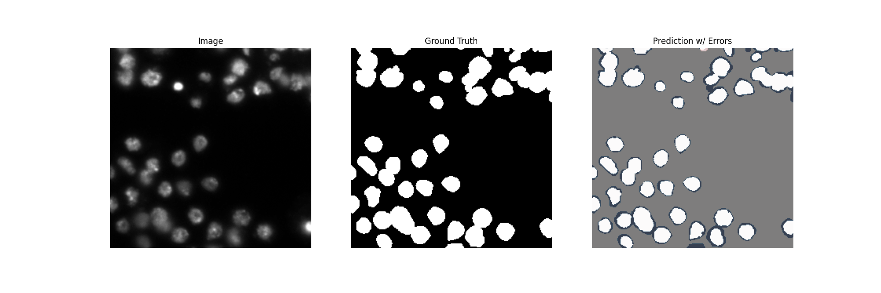 DeepNucNet microscopy image alongside the ground-truth nuclei segmentation mask and model prediction with errors